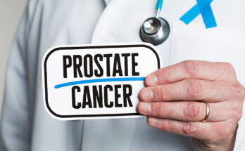 Prostate Cancer